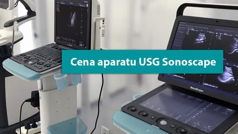 Cena aparatu USG Sonoscape – co się na nią składa?