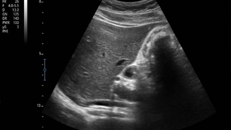 Aparat usg – jakie rodzaje ultrasonografów wykorzystują lekarze diagności?
